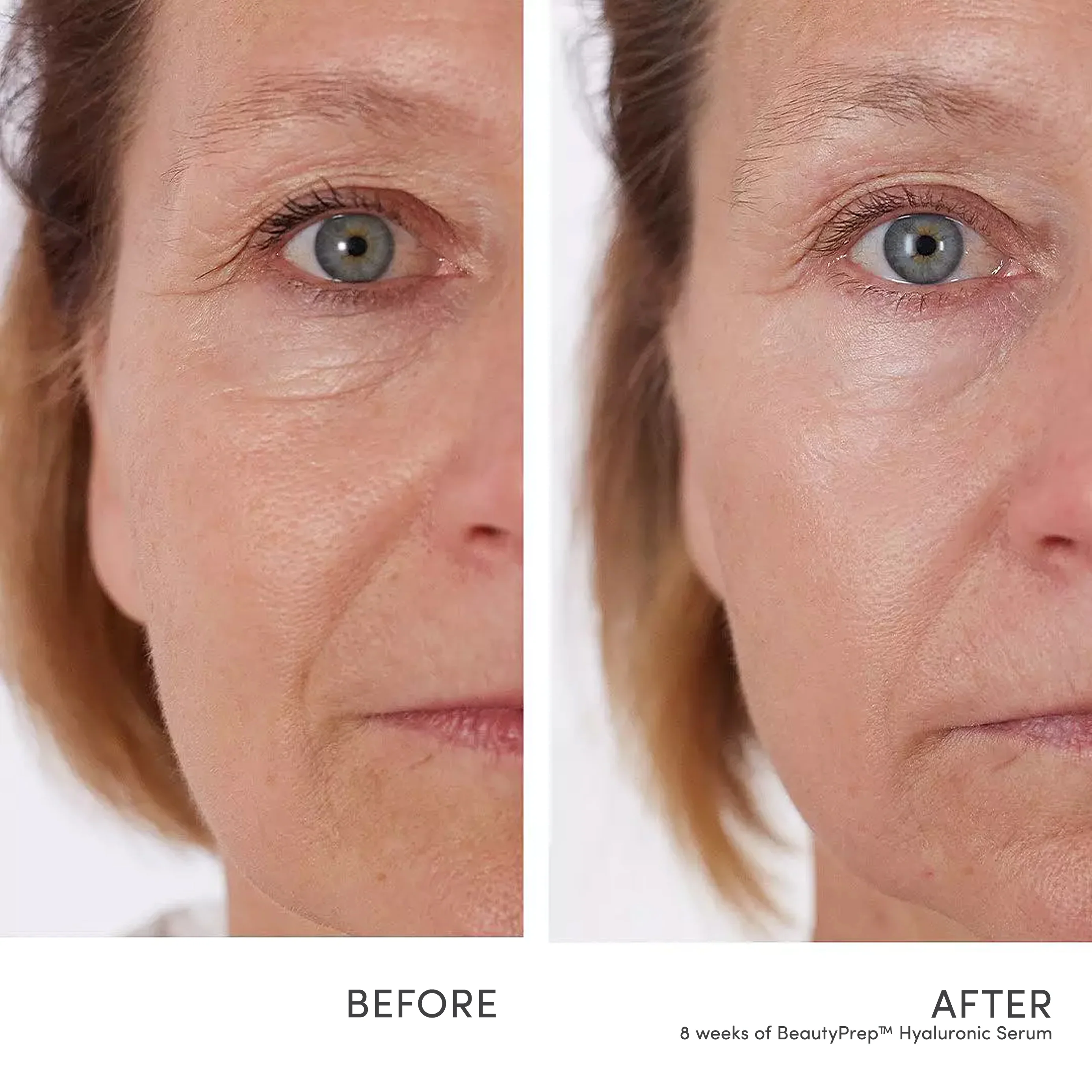 BeautyPrep™ Hyaluronic Serum - Image 3