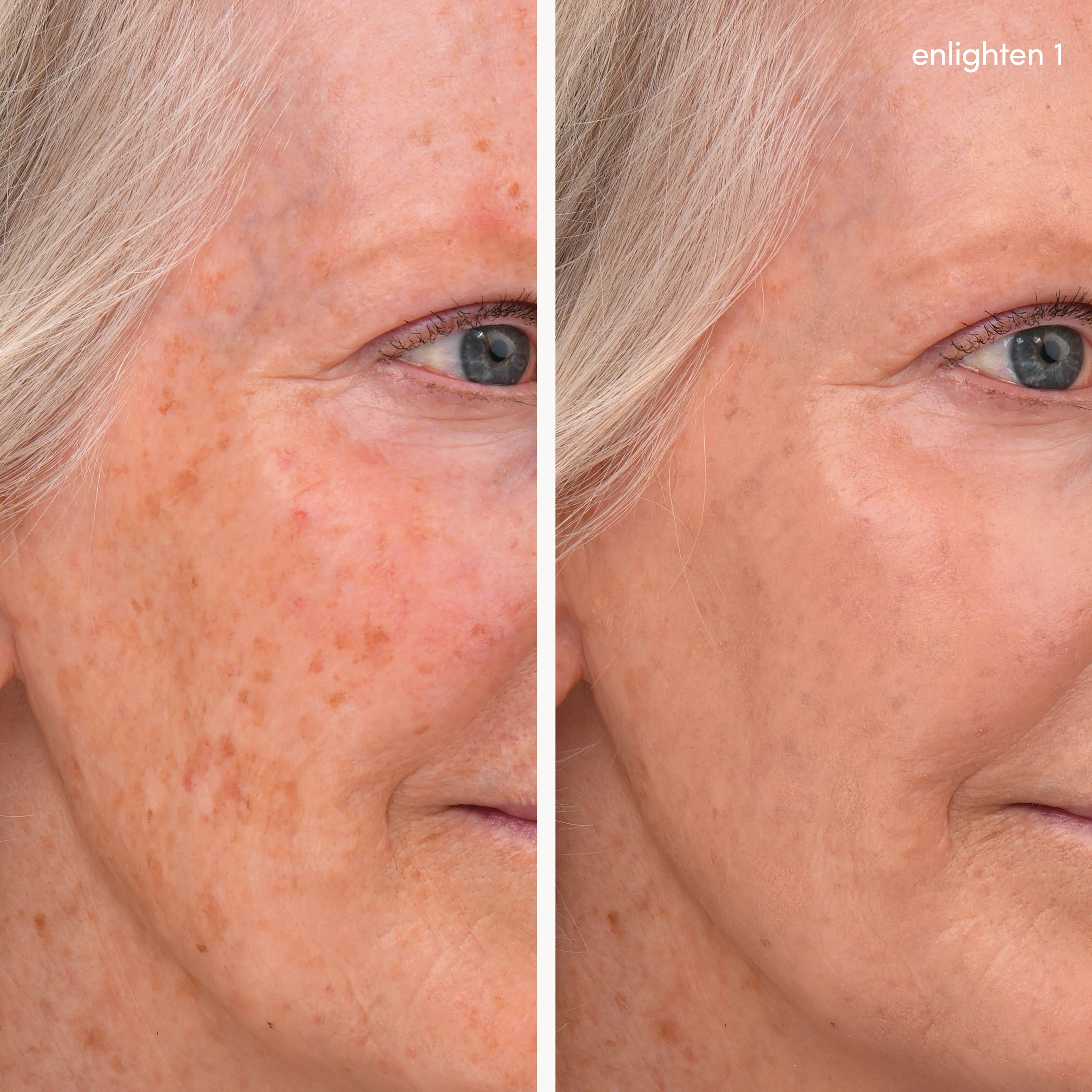 Enlighten Concealer™ - Image 5