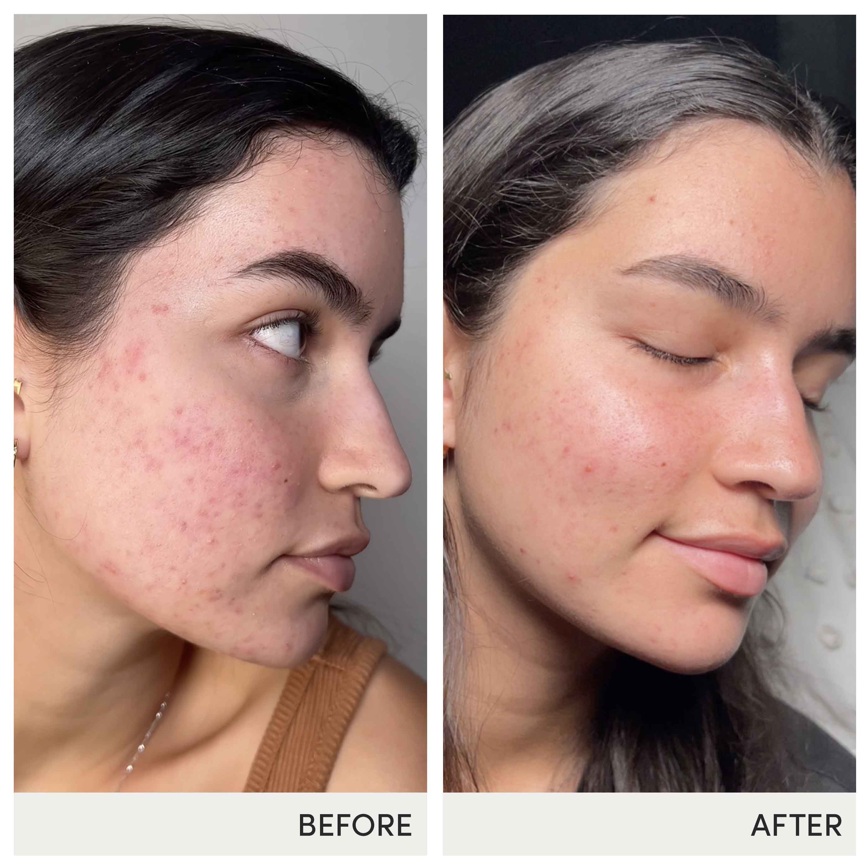 Skin Accumax® - Image 10