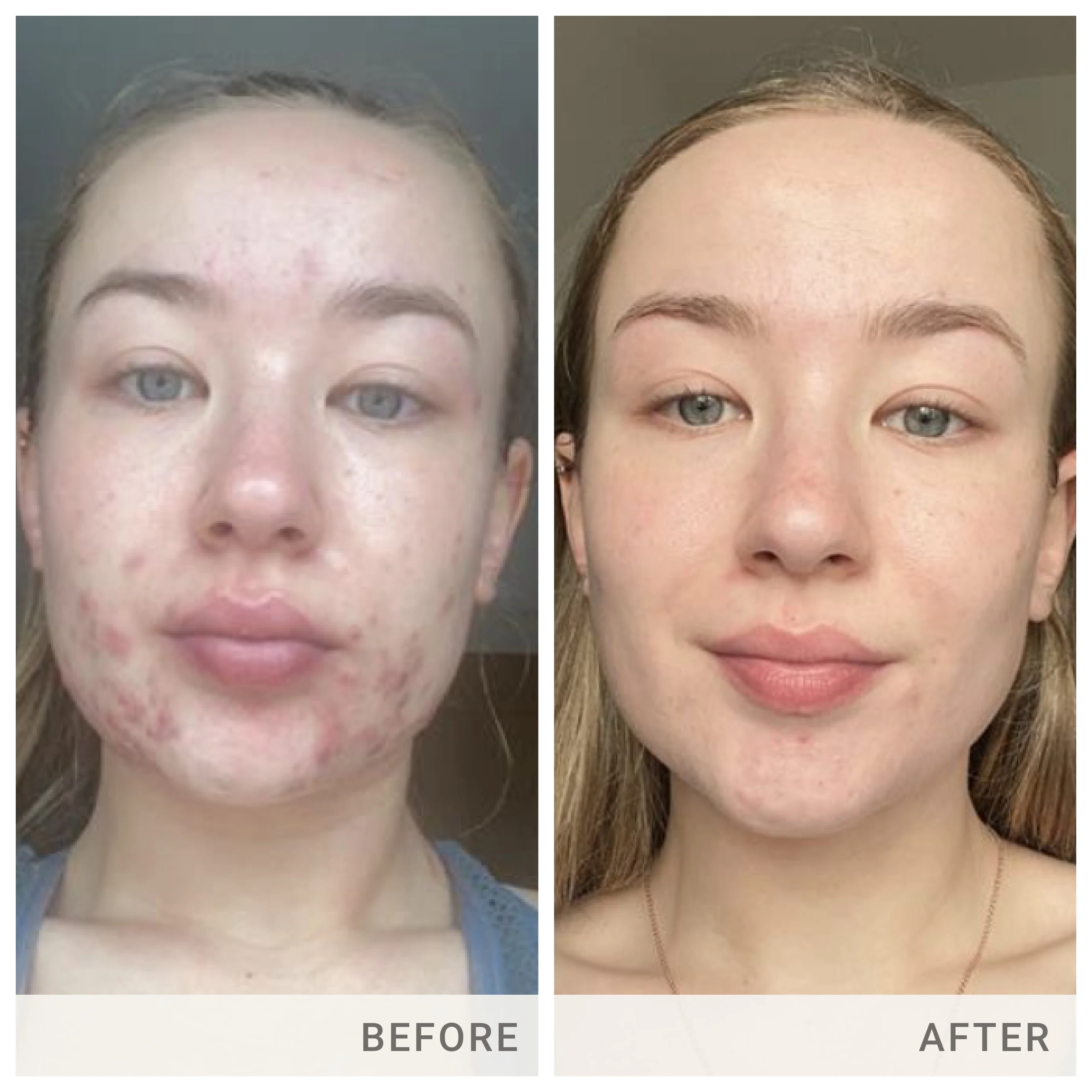 Skin Accumax® - Image 11