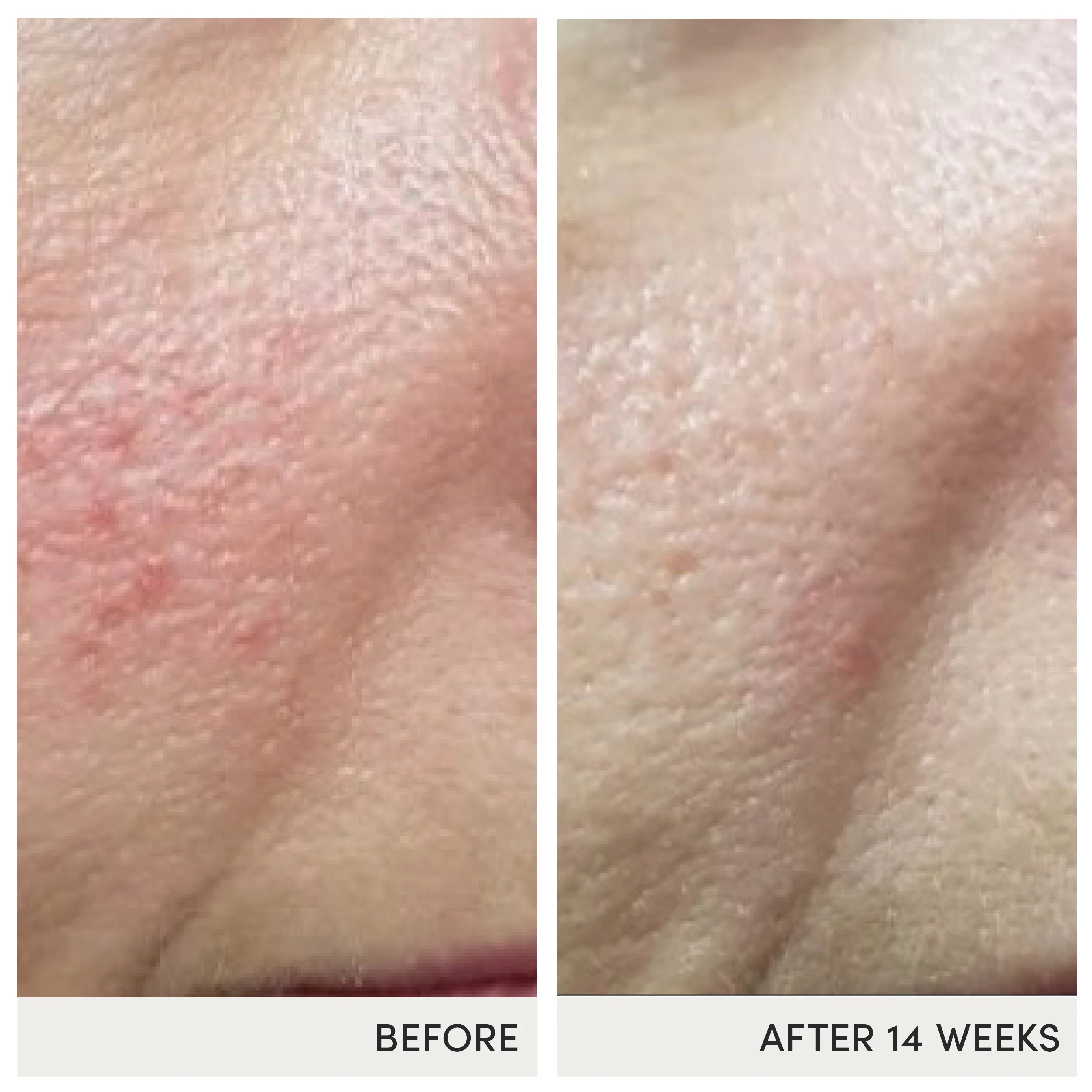 Skin Omegas - Image 6